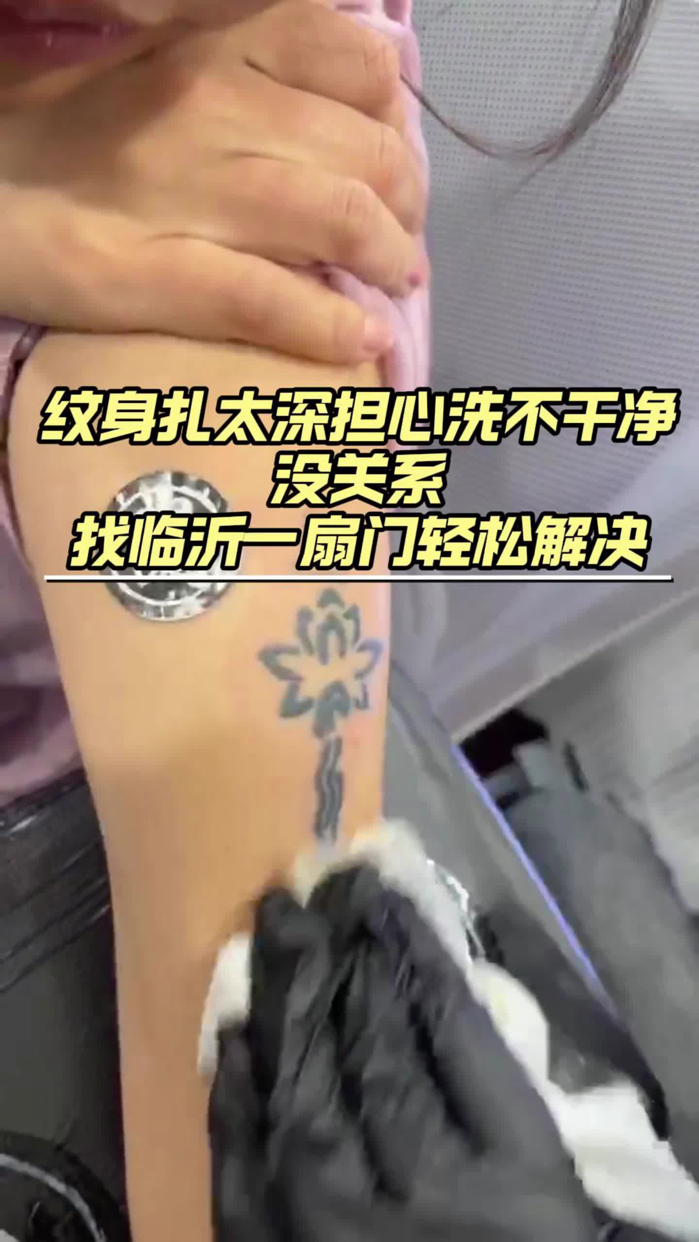 纹身担心洗不掉,找临沂一扇门专业洗纹身