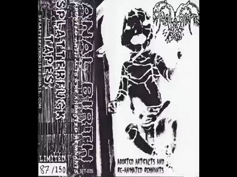 [图]【Gorenoise|Comp】Anal Birth - Aborted Artifacts And Re-Animated Remnants