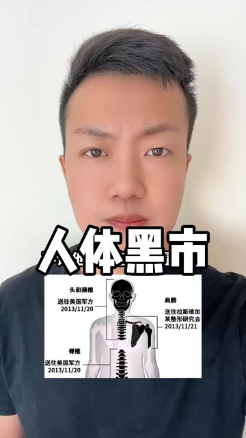 美国人体器官黑市交易