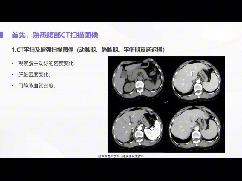 手把手教你读懂腹部CT肝胆胰脾篇(共26讲)哔哩哔哩bilibili