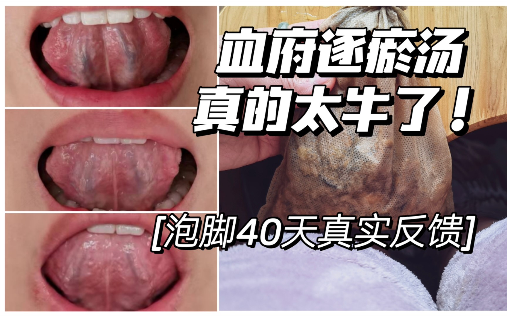 [图]调理月经，种子循环法VS血府逐瘀汤，膜拜传统医学！