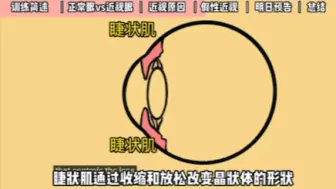 Download Video: 第一天｜30天试验外网已帮上万近视人群恢复裸眼视力的：Endmyopia摘镜训练法。 #近视 #视力训练 #打卡