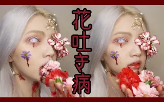 赤花症 搜索结果 哔哩哔哩 Bilibili