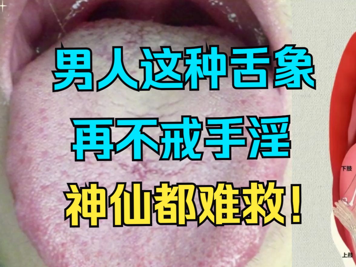 男人这种舌象,再不戒手淫,两腿一蹬,神仙难救!哔哩哔哩bilibili