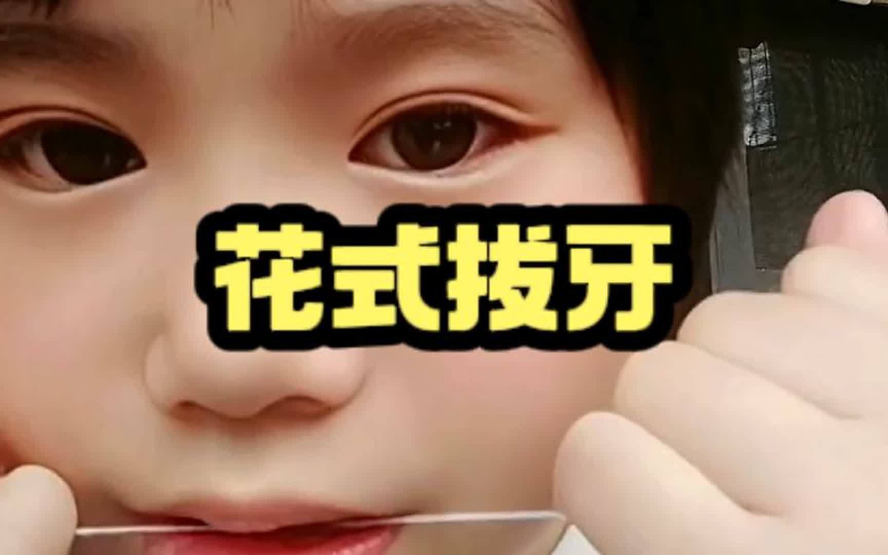 [图]盘点父母给孩子花式拔牙，谢谢妈妈 我真的爱你#拔牙 #换牙