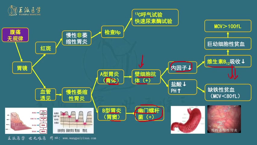 【王派】2024年执业医师助理医师考试视频 消化系统哔哩哔哩bilibili