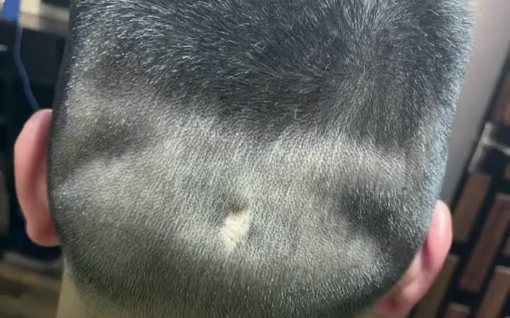 补头发种发纹头发 义乌 男士发型 刺青 手艺人 义乌纹身 懂你的发型师