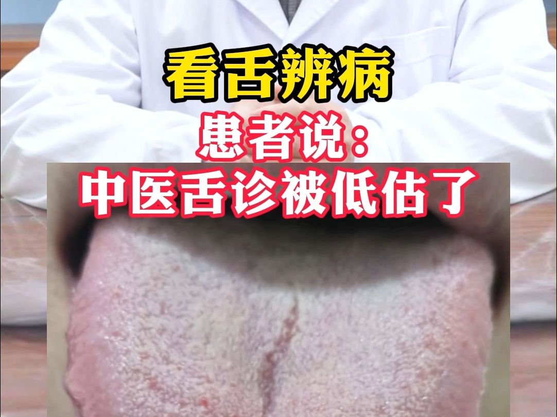 看舌辨病,你是哪种舌头?
