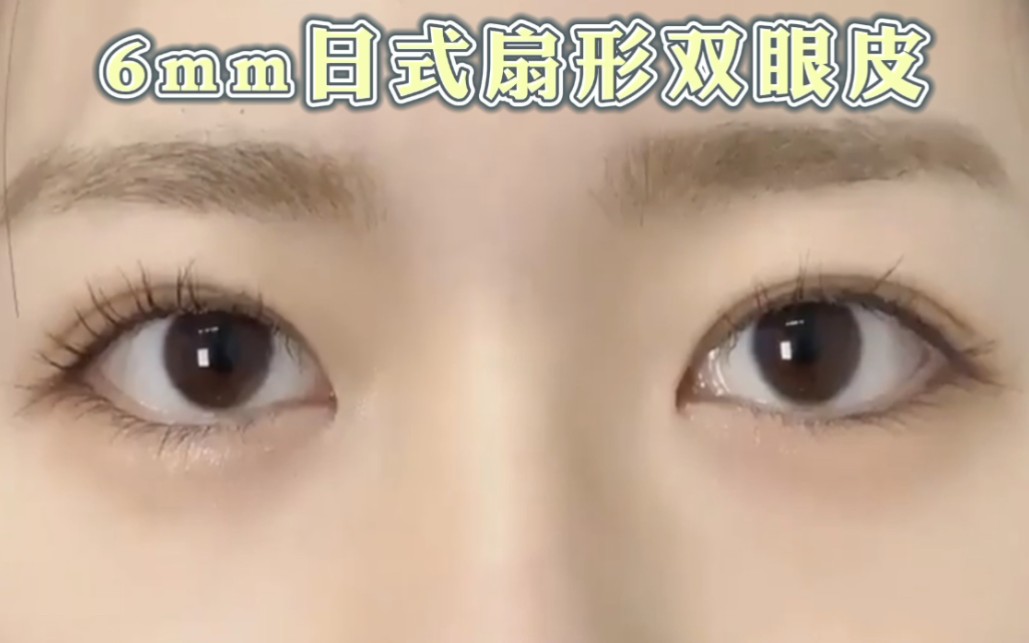 我的6mm日式扇形双眼皮太好看了吧