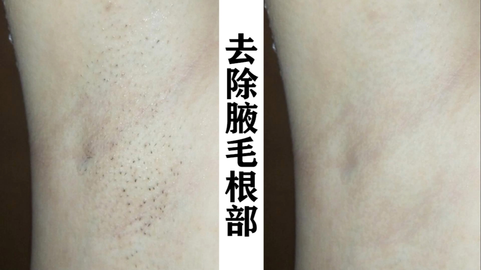 ps去除腋毛根部