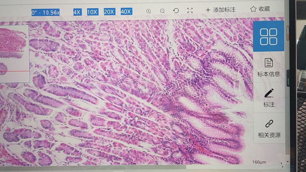 组胚切片胃黏膜上皮及固有层比较好辨别的结构哔哩哔哩bilibili