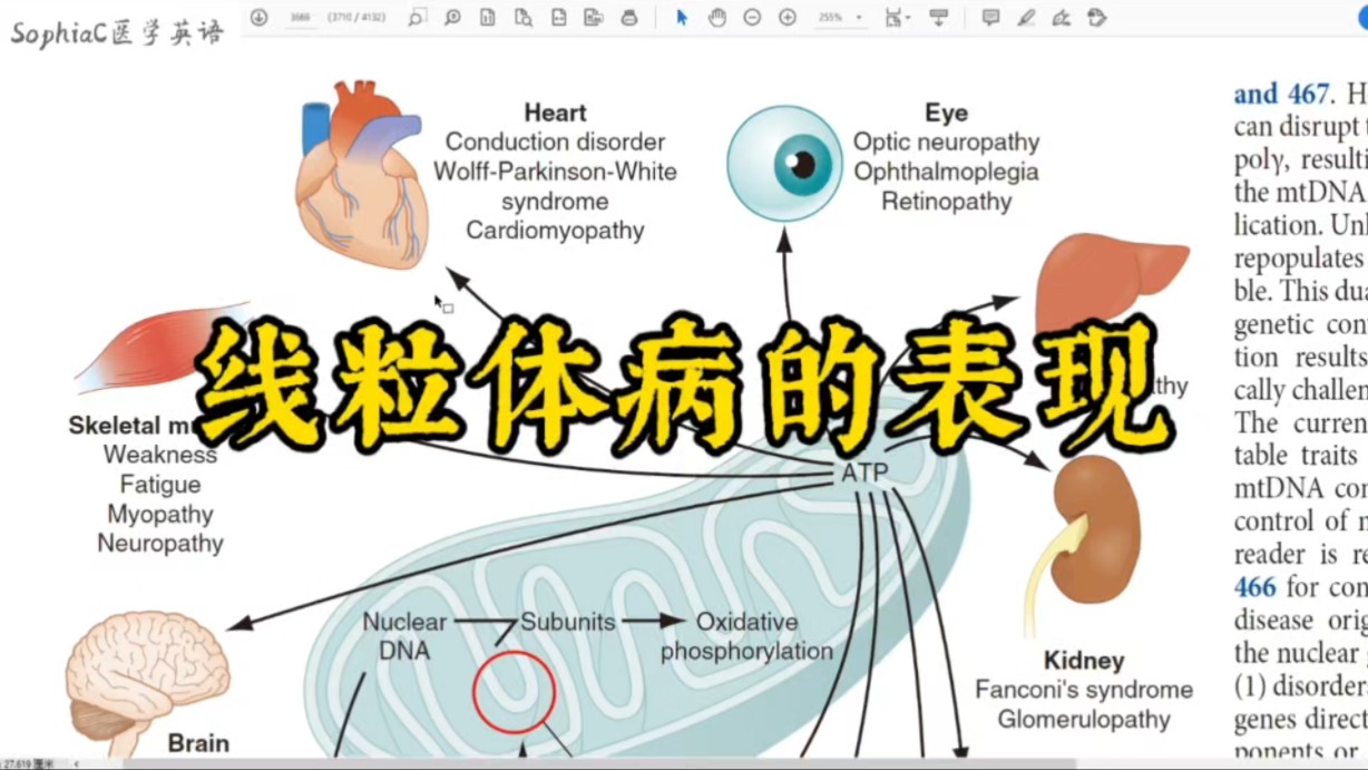 医学英语|线粒体病的表现.学好医学英语,畅读医学原著.哔哩哔哩bilibili