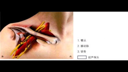 超声引导下的臂丛神经阻滞(锁骨下)图谱