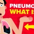 关于肺炎，你应该知道 | 医学动画 | 双语字幕 | 医学英语