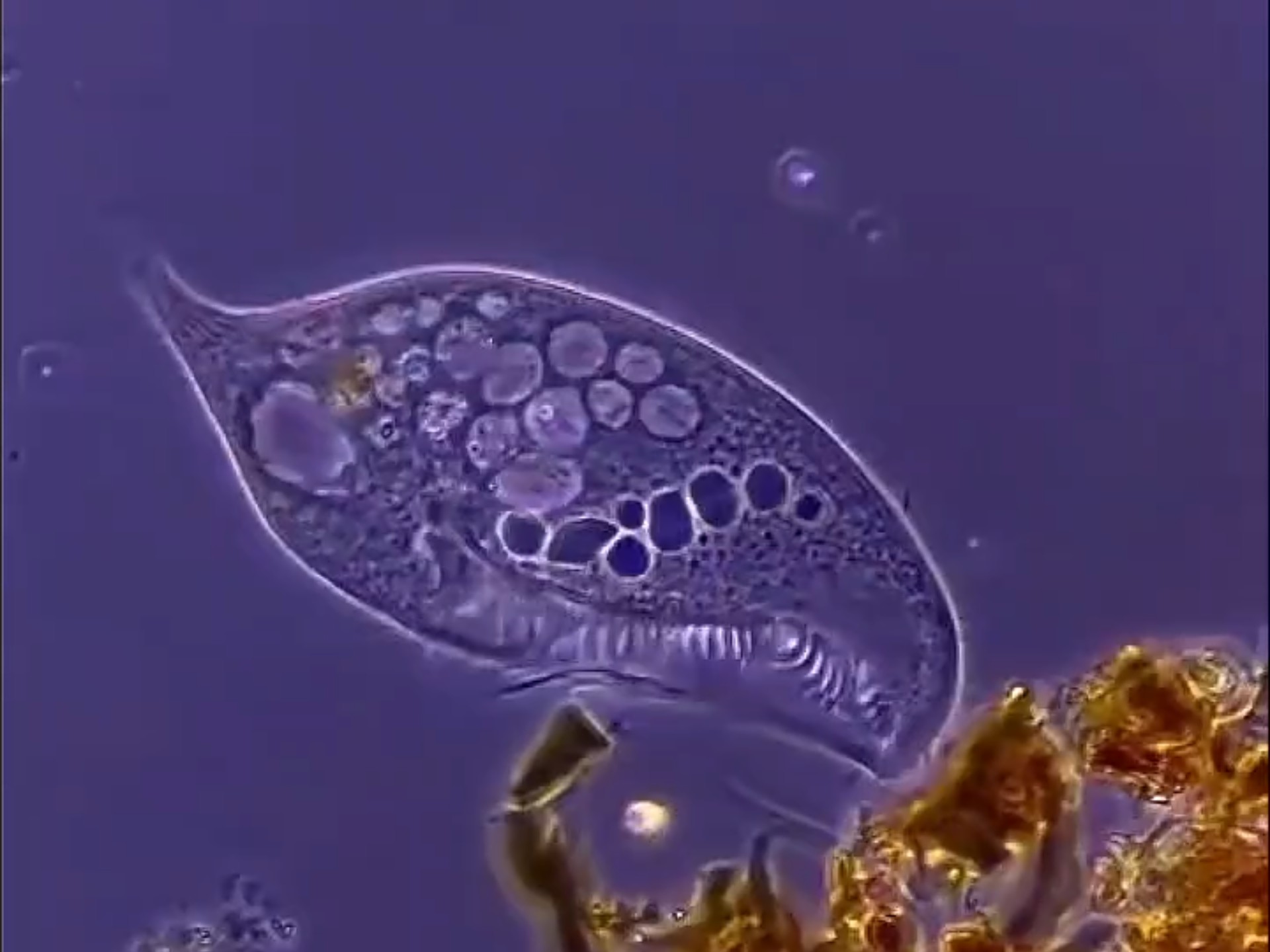 显微镜下的草履虫,现在好像不这样形容人了