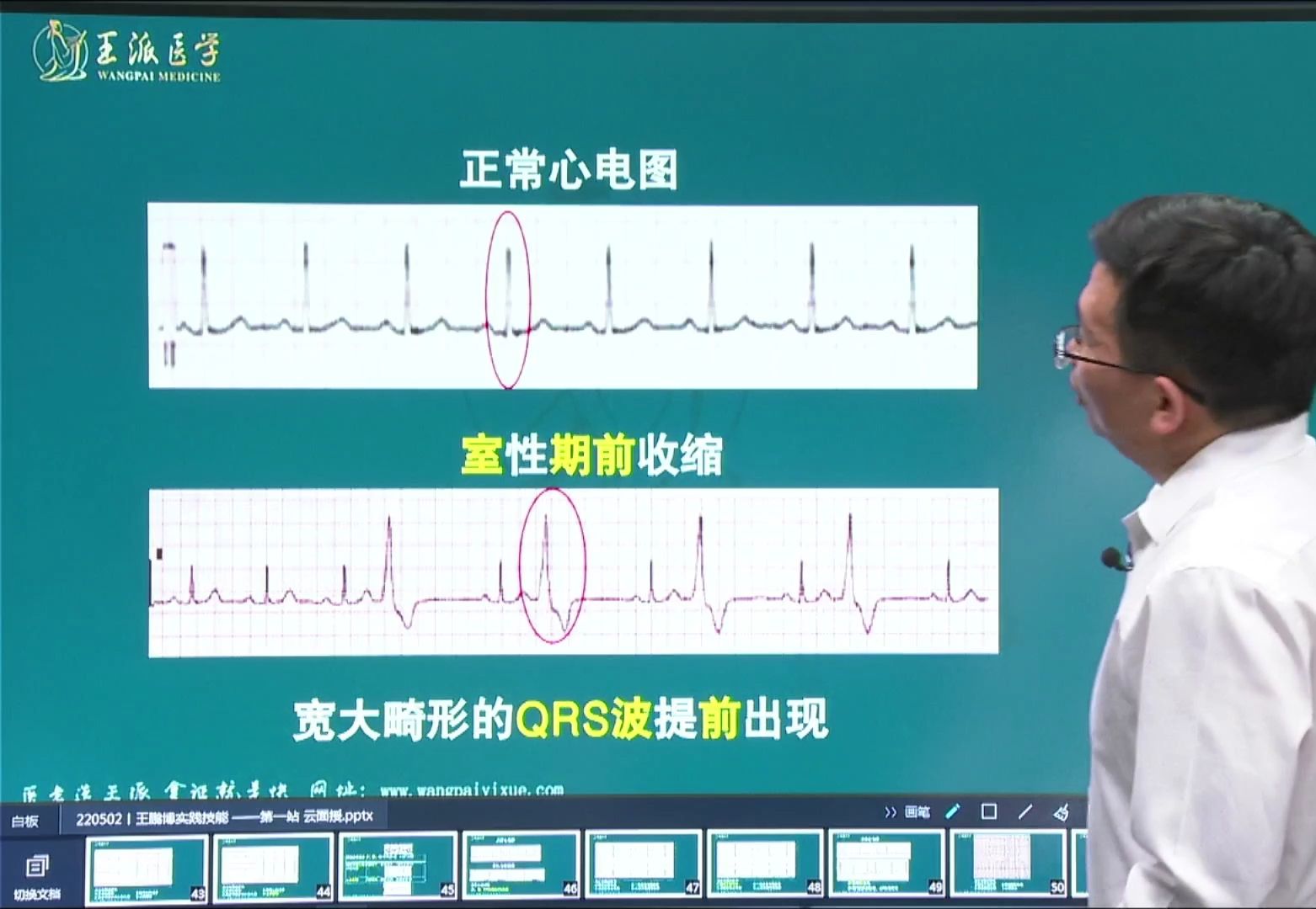 王博心电图医考必考点专讲室性期前收缩哔哩哔哩bilibili