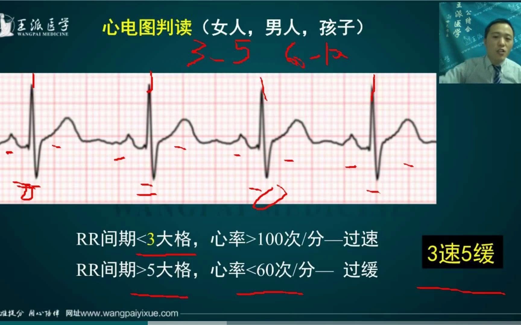 心电图判读哔哩哔哩bilibili