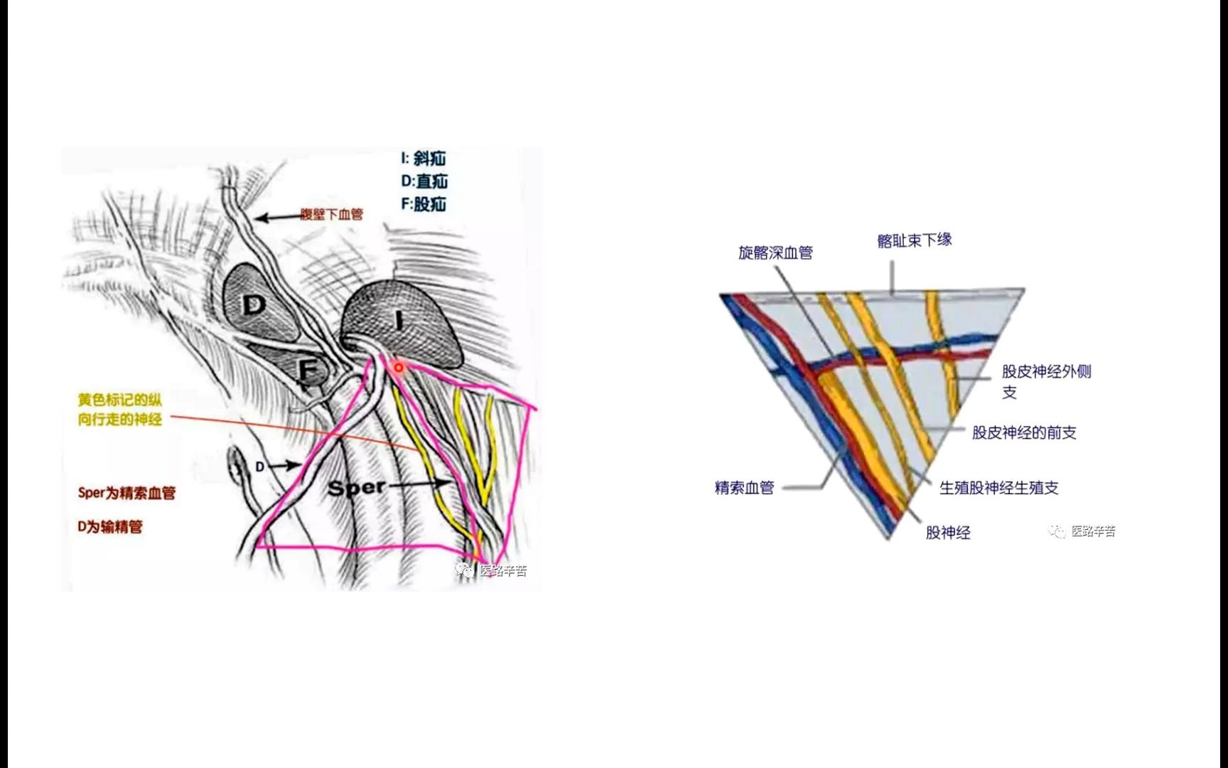 腹股溝區解剖-9.疼痛三角