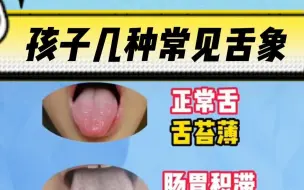 Download Video: 几种孩子常见的舌象图