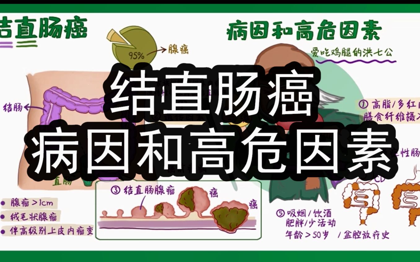 医学生动画笔记 结直肠癌的病因和高危因素