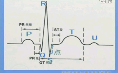 心电图解析哔哩哔哩bilibili