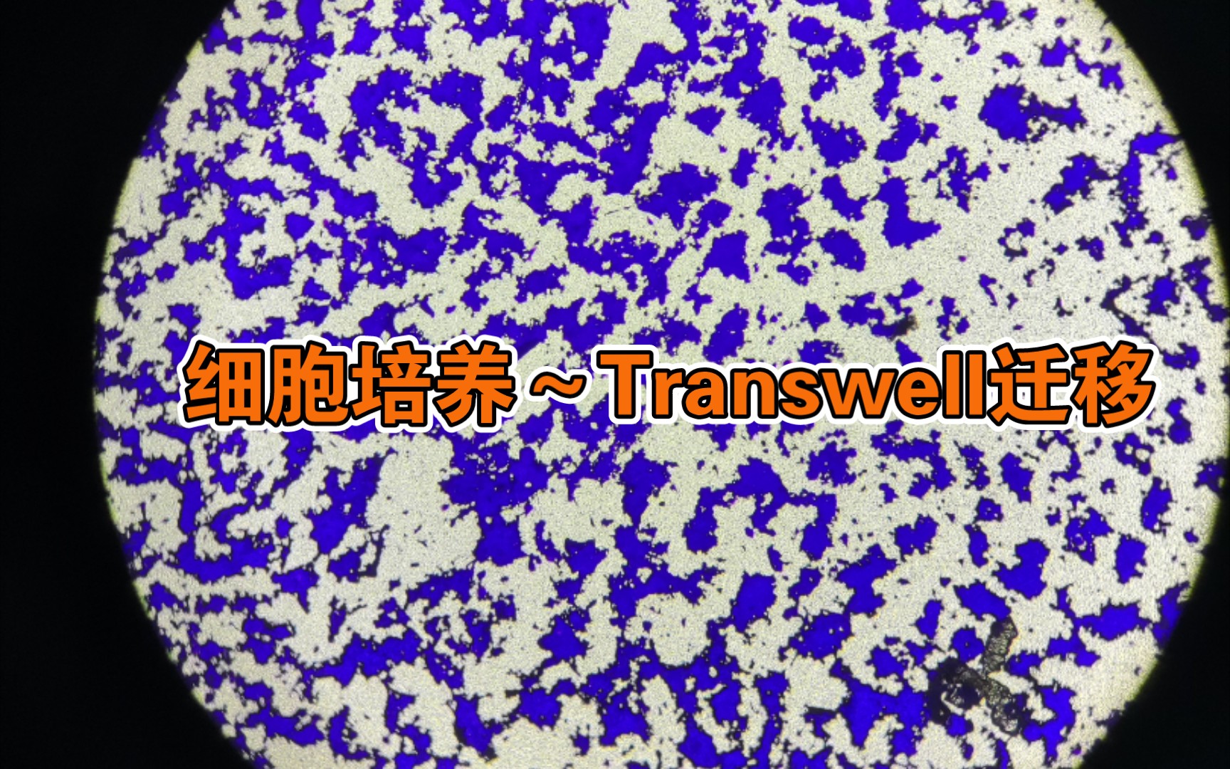 Transwell细胞迁移,染色哔哩哔哩bilibili