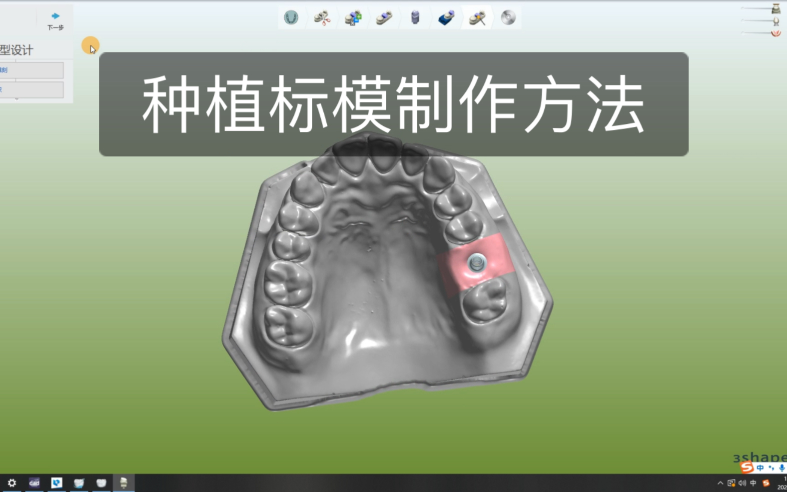 领导叫你制作标模还怎么做?Exocad种植标模制作方法哔哩哔哩bilibili