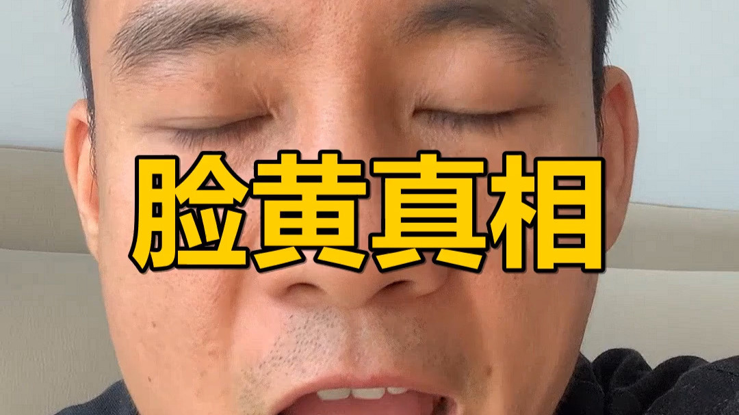 脸黄不是因为熬夜，是因为你的脾胃早就罢工了——十个人里八个中招