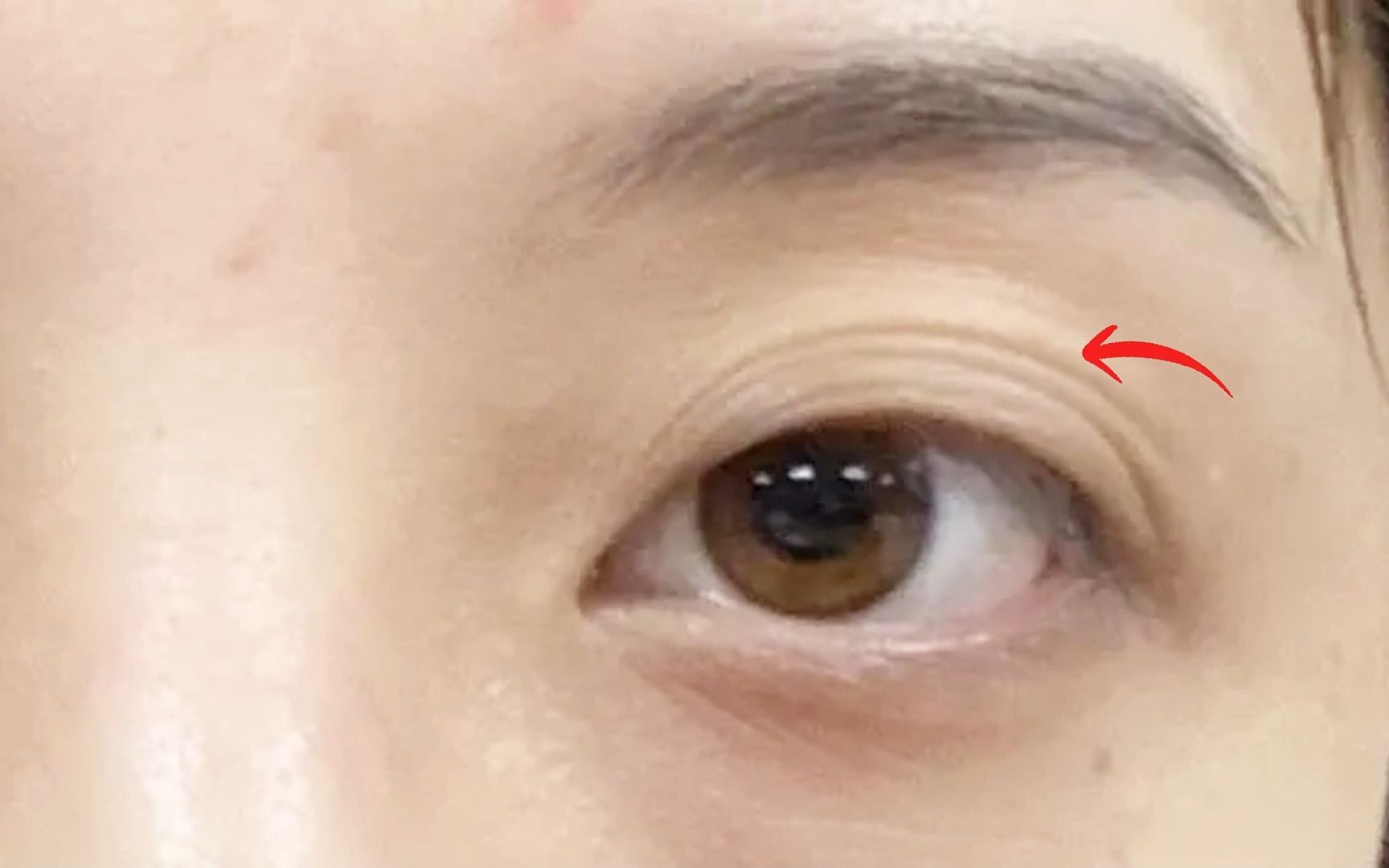 面相识人:多层眼皮