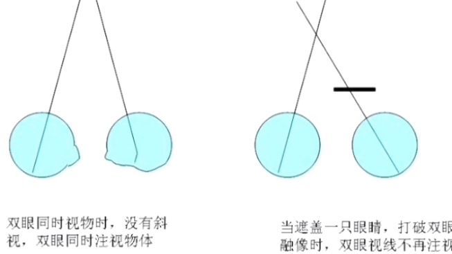 斜视配镜原则 1)外斜视、外隐斜 A合并远视,低矫配镜 B合并近视,足量矫正 2)内斜视,内隐斜 A合并远视,足量矫正 B合并近视,适当低度矫正 C调节...