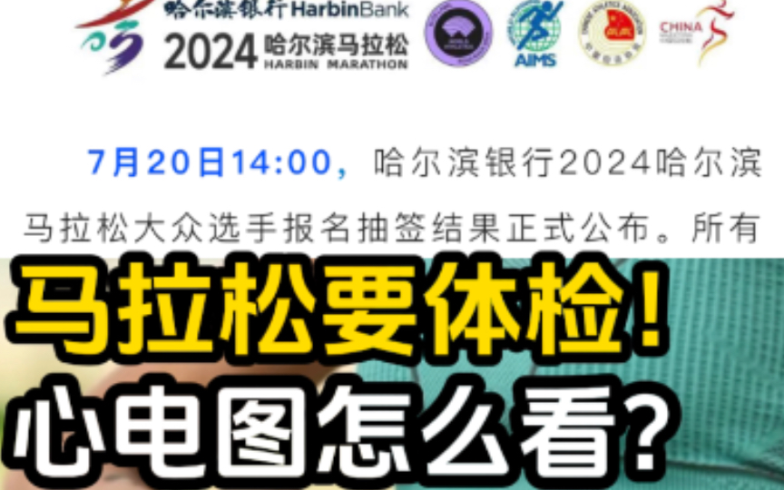 哈尔滨马拉松报名抽签完要体检报告!哈尔滨马拉松报名抽签后需要体检报告!心电图上的窦性心率和计算目标燃脂心率的静息心率有区别吗?哔哩哔哩...