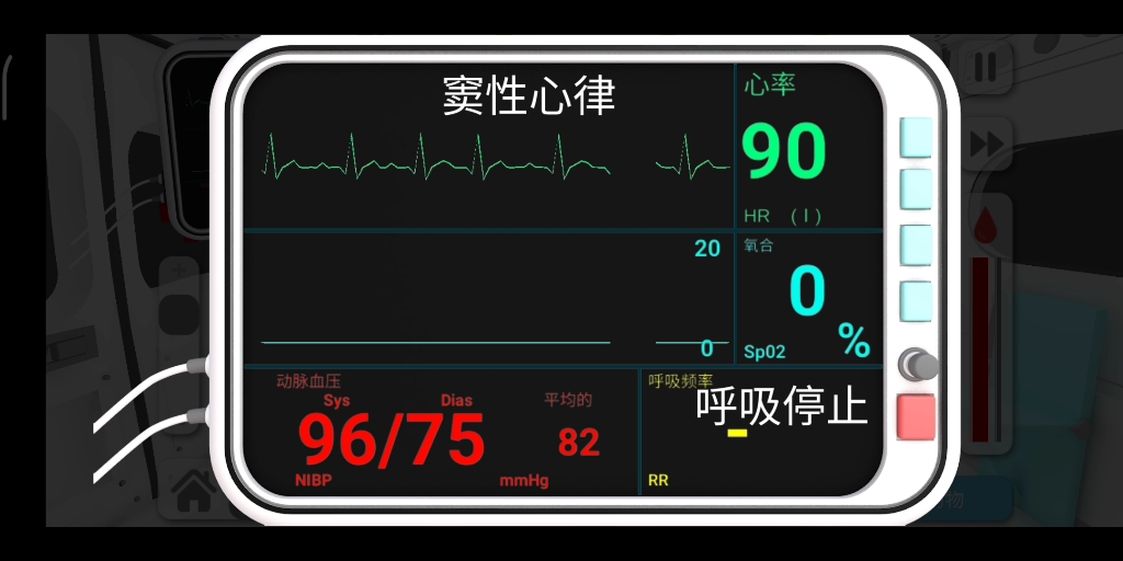 低血糖病人监护仪哔哩哔哩bilibili