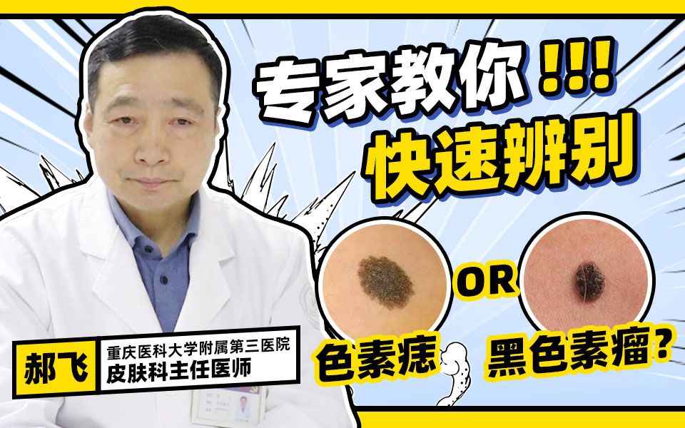 [图]长痣别大意！色素痣和色素瘤如何区分？三甲主任为你快速解答