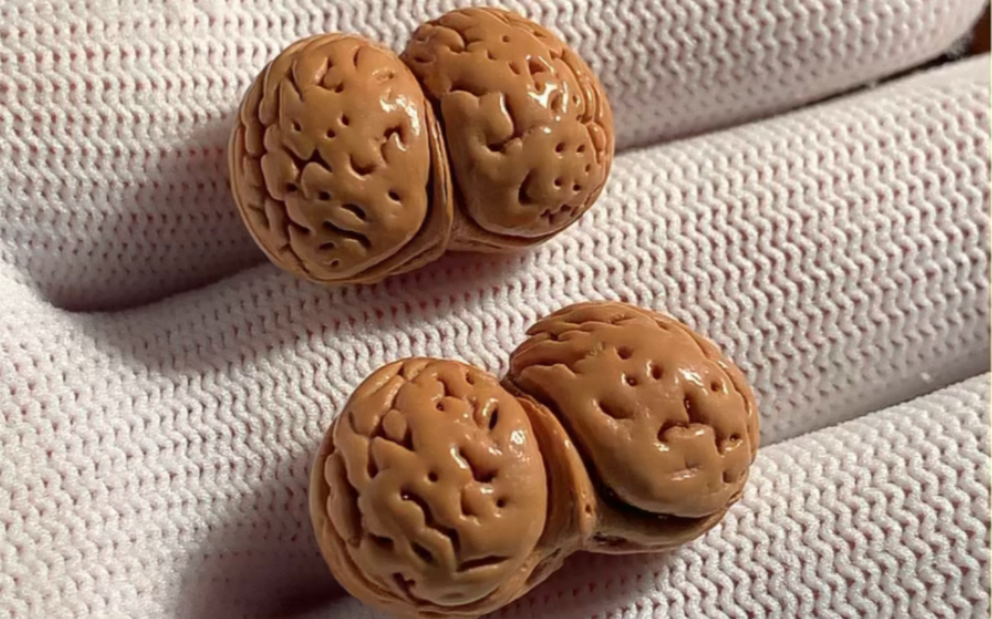 天然异形,桃核连体