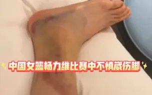 Download Video: 中国女篮杨力维在比赛中不慎崴伤脚，正在康复中……让我们为坚强的女篮姑娘点赞