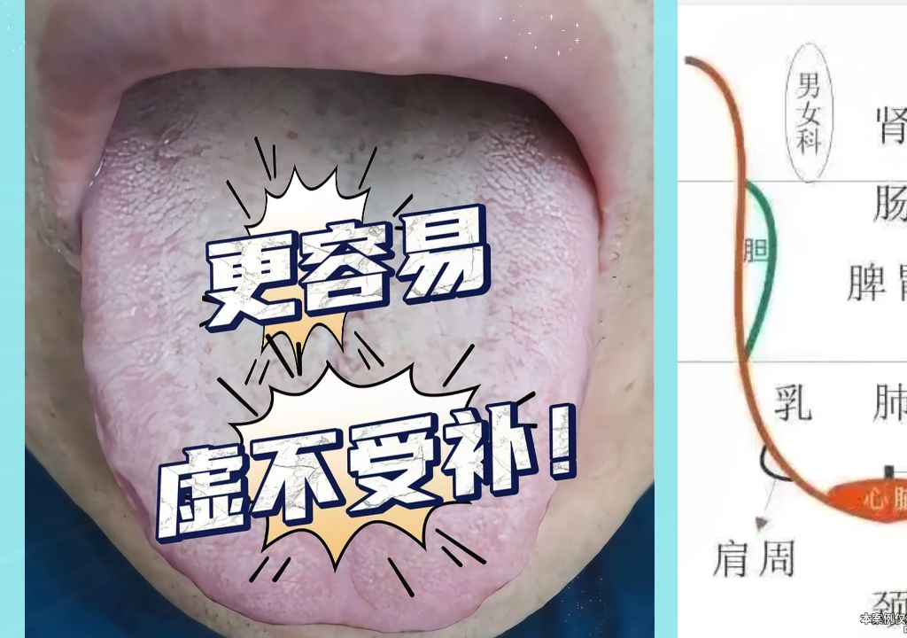 出现这种舌象,不要再盲目进补了,小心越补越虚!