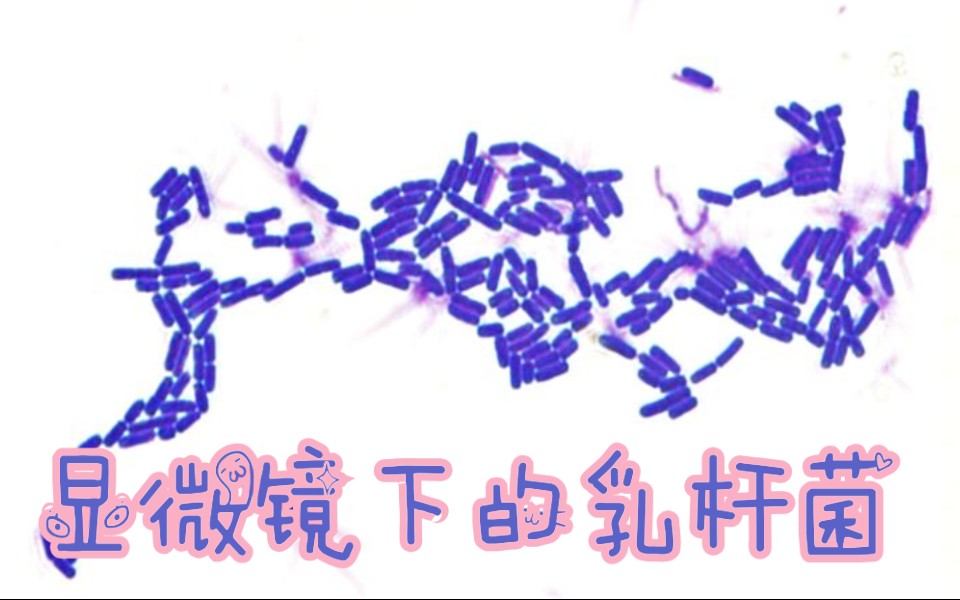 乳杆菌制片镜检全过程