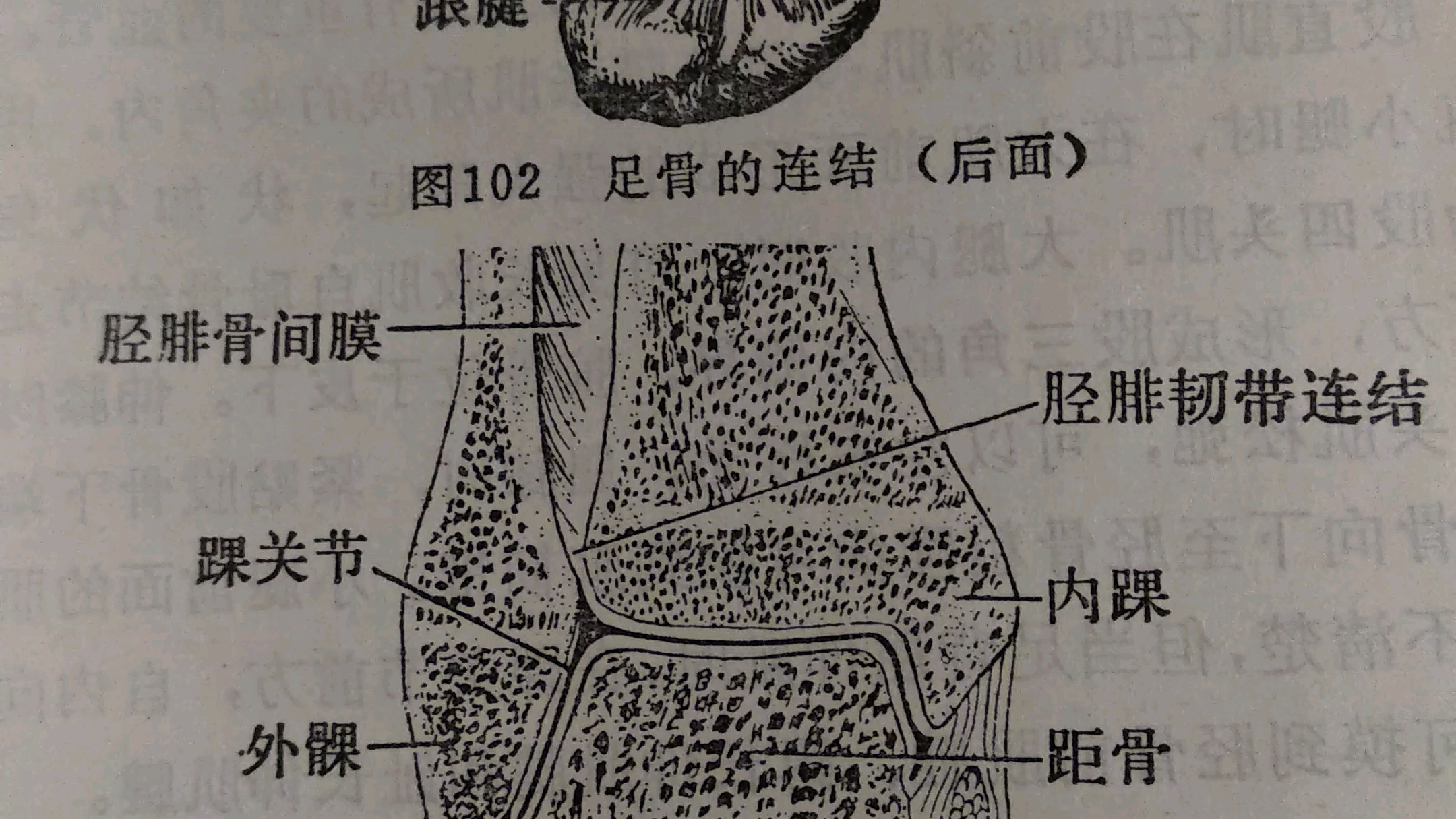 图102足骨的连结后面图103踝关节额状切面