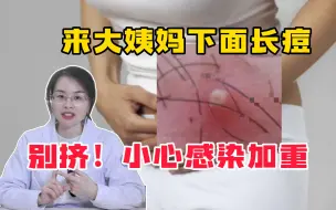 Tải video: 【科普】女生必看！你下面冒出的又肿又痛的小痘痘，其实是因为这个！