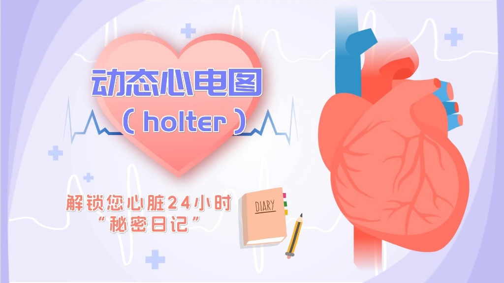 动态心电图(holter),解锁您心脏24小时“秘密日记”哔哩哔哩bilibili