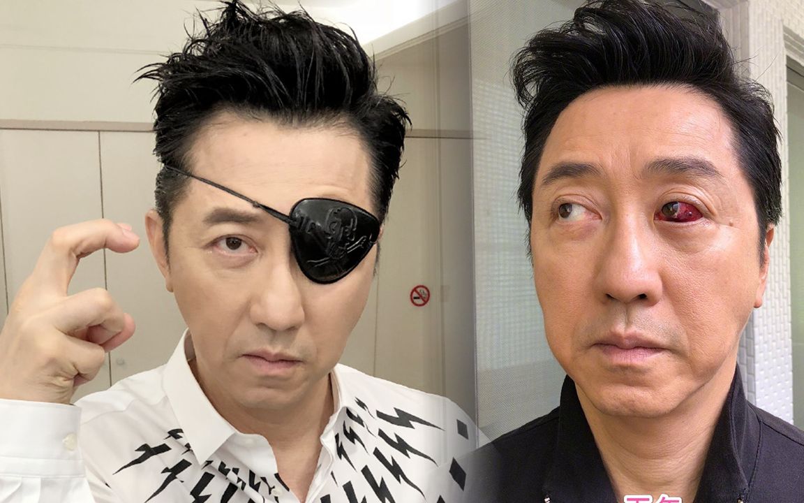 庾澄庆眼球血管爆裂,网友直言像看恐怖片,未来可能再复发第4次