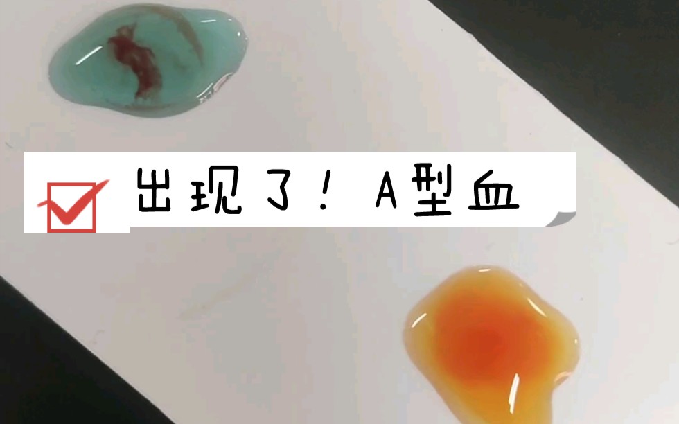 【医学微生物学】凝集反应哔哩哔哩bilibili