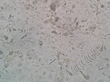 空泡型人芽囊原虫