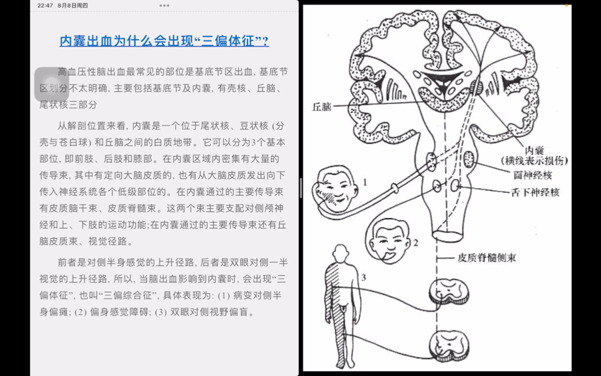 苯丙酮尿症发病机制图片