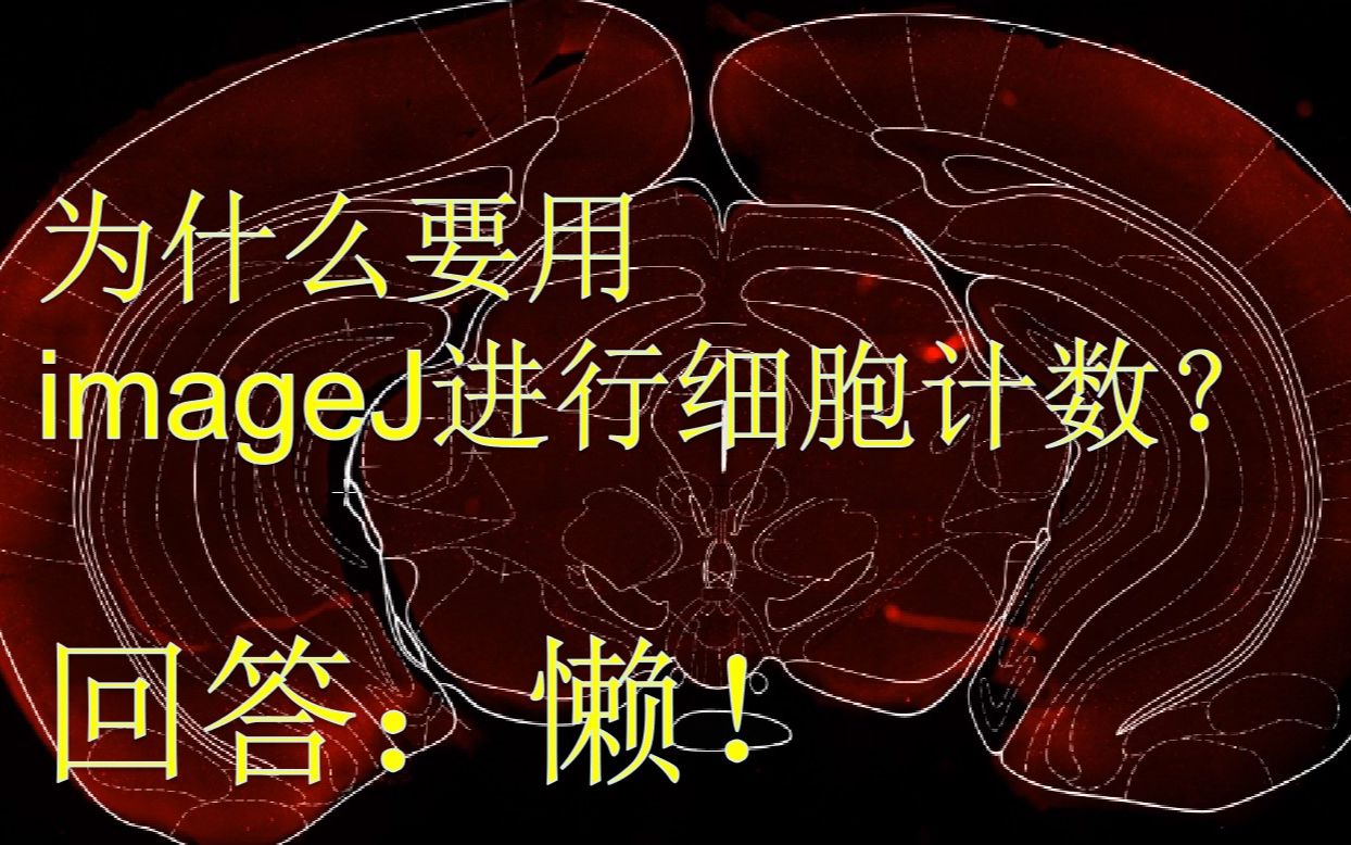 ImageJ细胞计数操作演示哔哩哔哩bilibili