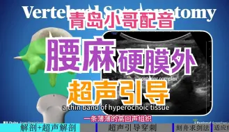 Descargar video: 【麻醉技术】超声引导腰麻/硬膜外麻醉 青岛小哥配音 慢速0.8 双语字幕 翻译人工校对