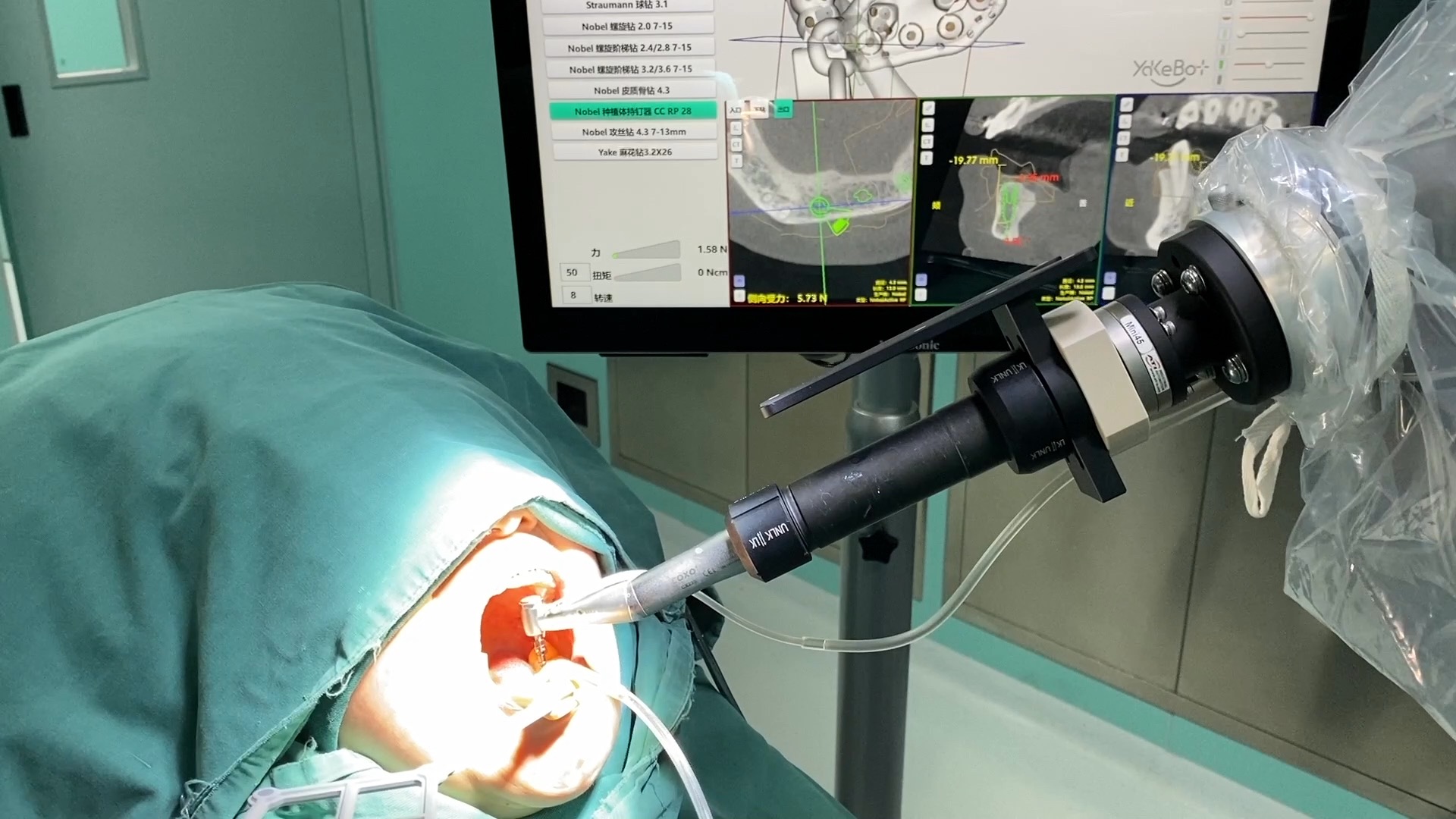 机器人种植即刻负载