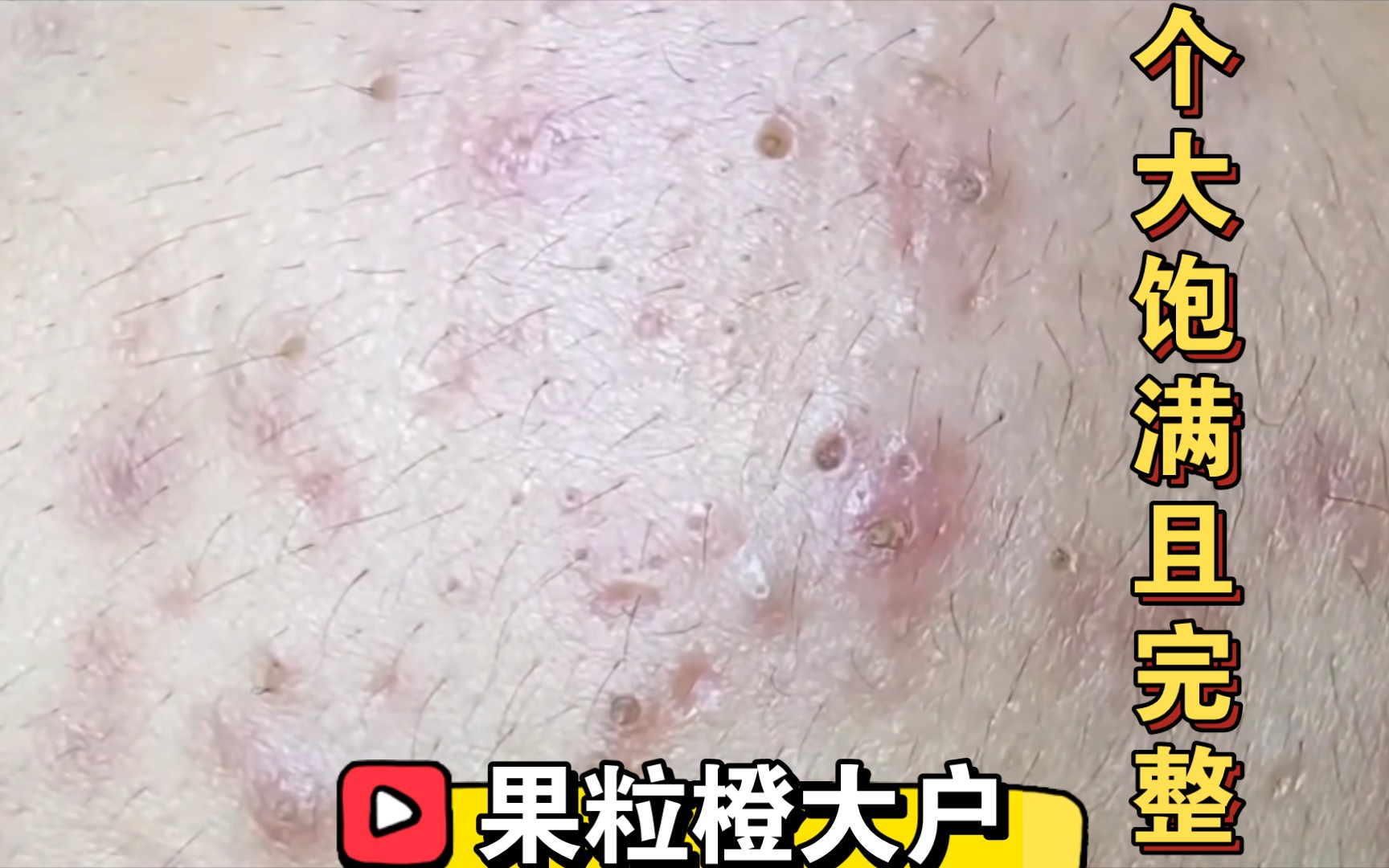 【长视频】【沉浸式体验】深层黑头清除|舒缓放松|皮肤管理|解压清洁