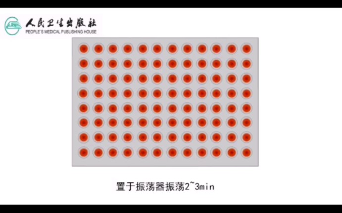 【人体寄生虫学】日本血吸虫血清IHA检测哔哩哔哩bilibili