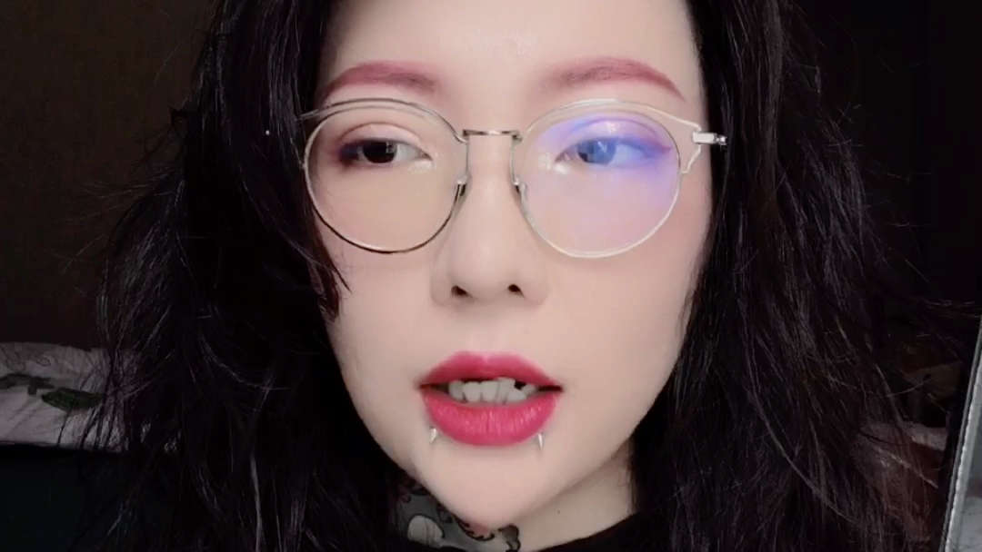 关于微笑钉你必须要知道的事2